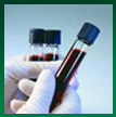 Test Tube Shipper - DVG Packaging